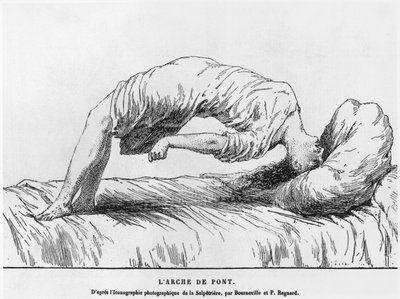 Histeri ve uyurgezerlik, Les Maladies Epidemiques de lEsprit