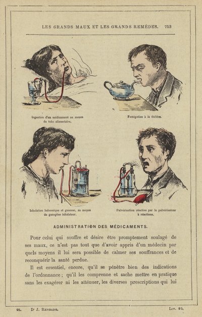 Gıda tüpü aracılığıyla bir ilacın yutulması, Çaydanlık ile fümigasyon, Balzamik ve gazlı soluma, inhaler gazlaştırıcı aracılığıyla, Reaksiyon püskürtücüsü ile reaktif püskürtme (renkli lito) by French School