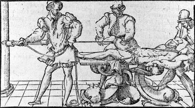 Çıkığın azaltılması, -“Ambroise Paré Tıbbi Antlaşması”nda, yaklaşık 1560. by French School
