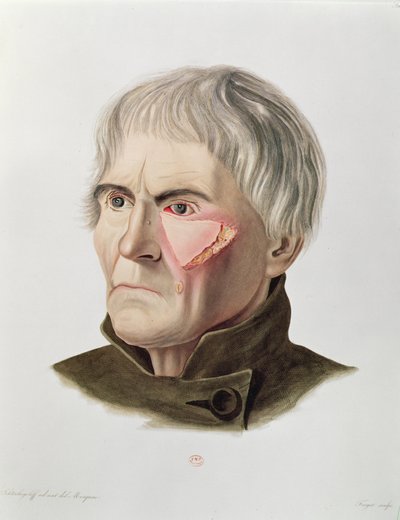 Alexander Auvert, Paris, 1856 tarafından Selecta Praxis Medico-Chirurgica