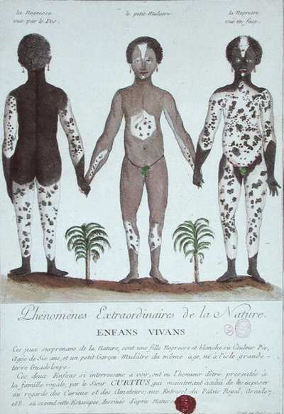 Lökoderma Fenomeni by French School
