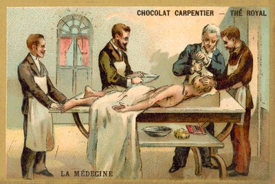 Trepanning (kromolito) by French School