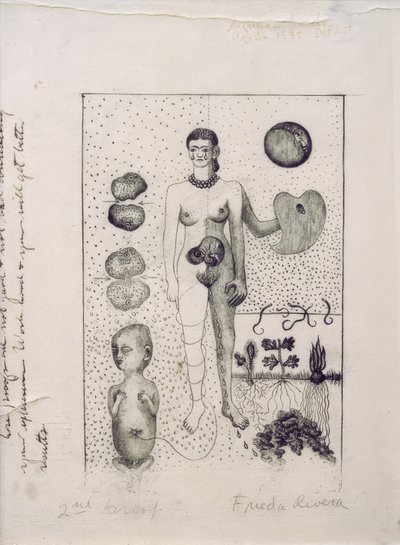 Frida ve Düşük by Frida Kahlo
