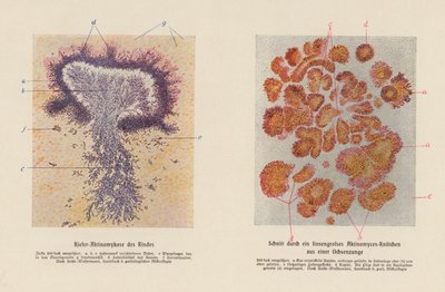 Actinomyces bovis (renkli lito) by German School