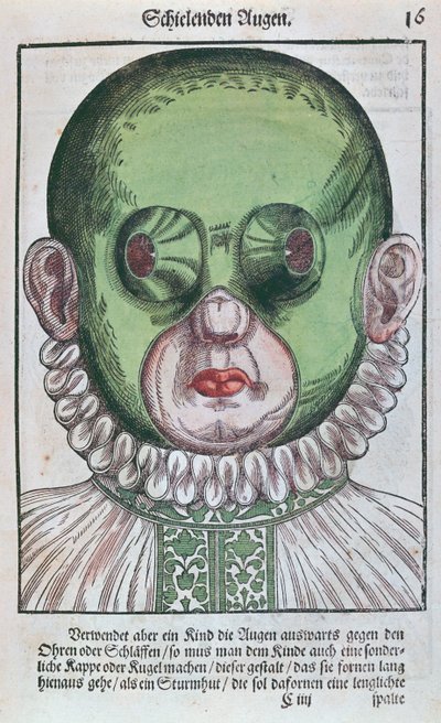 Şaşılık tedavisi için maske, Georg Bartisch (1535-1636) tarafından Dresden