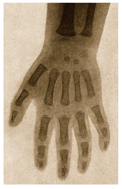 Bir çocuğun elinin röntgeni c.1890 by German School