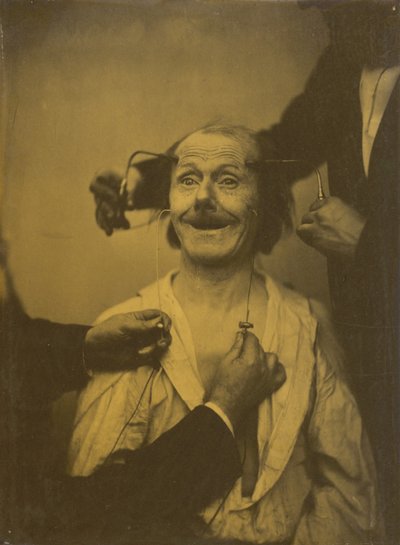 Hoş bir sürpriz veya hayranlığın yanlış, eksik ifadesi by Guillaume Benjamin Amant Duchenne