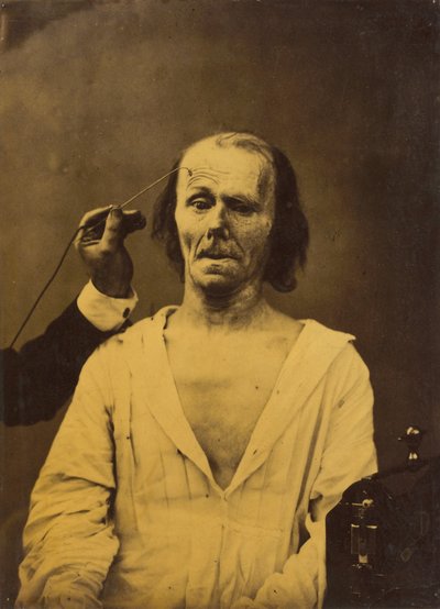 Rahat bir yüz (solda); Derin dikkat (sağda) by Guillaume Benjamin Amant Duchenne