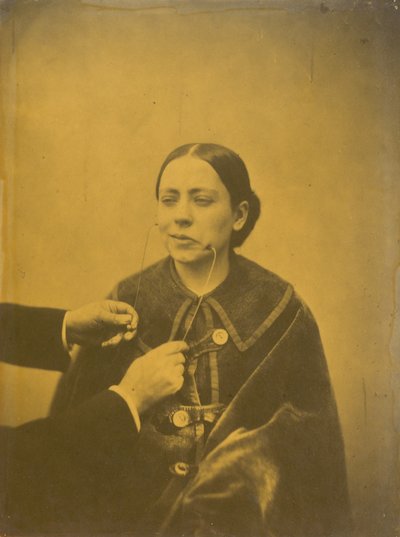 Alaycı iğrenme (solda); Alaycı kahkahalar (sağda) by Guillaume Benjamin Amant Duchenne