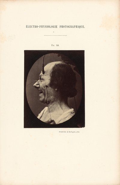  by Guillaume Benjamin Duchenne