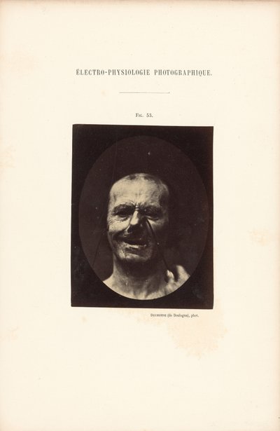  by Guillaume Benjamin Duchenne