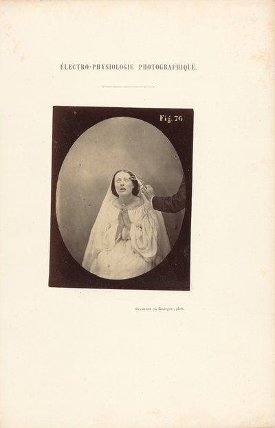  by Guillaume Benjamin Duchenne