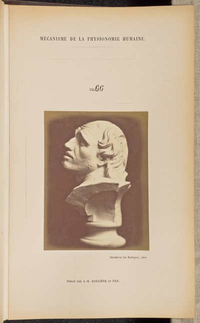  by Guillaume Benjamin Duchenne
