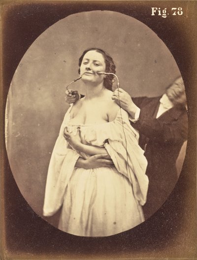  by Guillaume Benjamin Duchenne