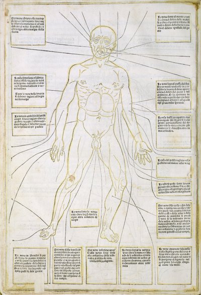 'Fassiculus Medicinae' Venedik'ten bir çizim by Italian School