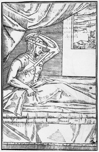Burunda rekonstrüktif cerrahi, Gaspare Tagliacozzi (1545-99) Venedik tarafından De curtorum chirurgia per insitionem