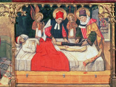 126-0035321 SS. Cosmas ve Damian, Etiyopyalı bir adamın bacağını diyakoz Justinian