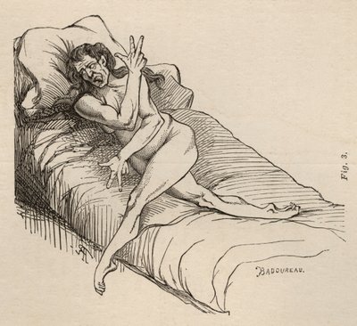 Histerik epilepsi, atak, bükülmeler, şek. 3, Bourneville et P. Regnard, Paris, 1876 tarafından 