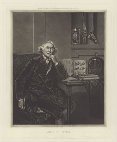 ಜಾನ್ ಹಂಟರ್, ಸ್ಕಾಟಿಷ್ ಸರ್ಜನ್ ಟರ್ಕ್ by Joshua Reynolds