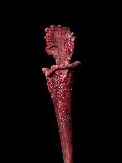  by Mat Collishaw