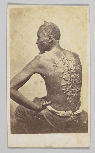 Gordon Tıbbi Muayene Altında, 1863. by McPherson and Oliver
