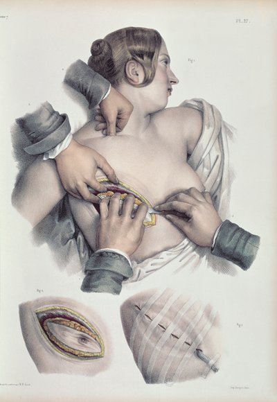 Jean-Baptiste Marc Bourgery (1797-1849) 1866-67