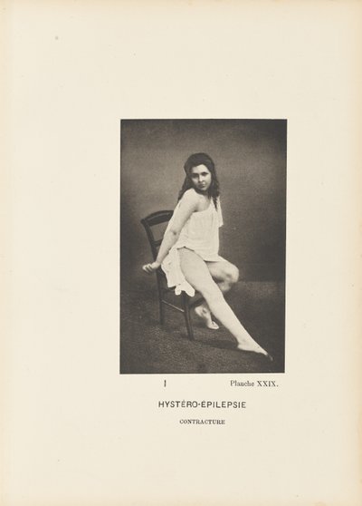 Histero-epilepsi Kontraktürü by Paul Marie Léon Regnard