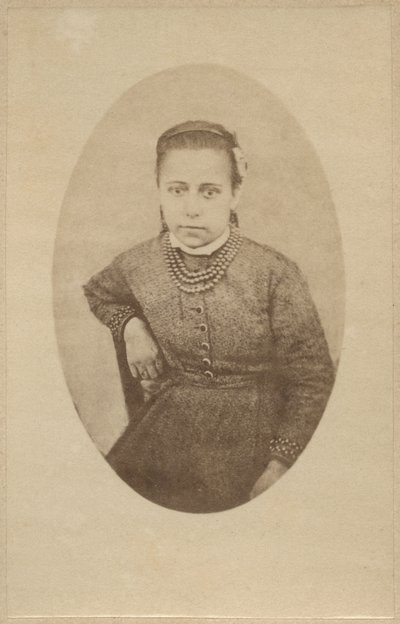 Histeri, normal görünüm, Bourneville ve P. Regnard
