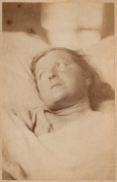 Histerik epilepsi, çarmıha germe, kafa tutumu, Bourneville ve P. Regnard, Paris, 1876