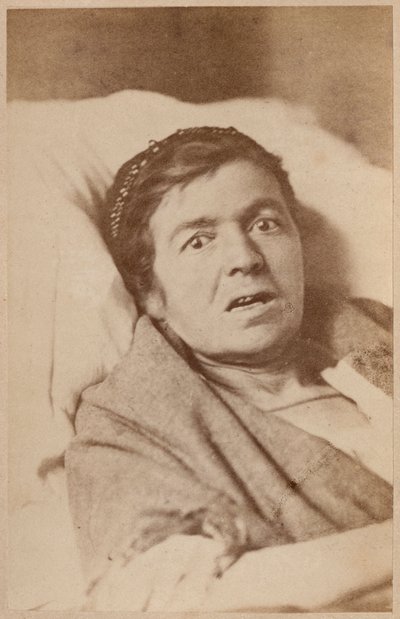 Histerik epilepsi, yüz kasılması, Bourneville ve P. Regnard'ın 'Iconographie Photographique de La Salpetriere' adlı eserinden VIII. plaka, Paris, 1876 (albüm baskısı) by Paul Regnard