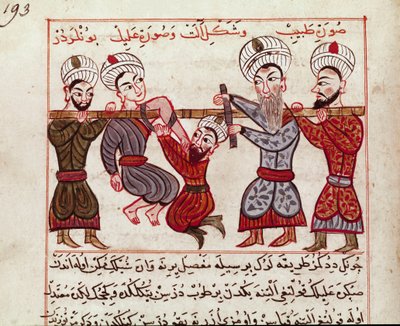 Tıp: ortopedik müdahale. “La Surgery Imperiale”den sonra Charaf-ed-din (Charaf ed Din) (1404-1468) tarafından Türk tıbbının sağımından alınan minyatür (Ms Sup Turk 693 fol. 193) 1466 Paris, B.N. by Persian School