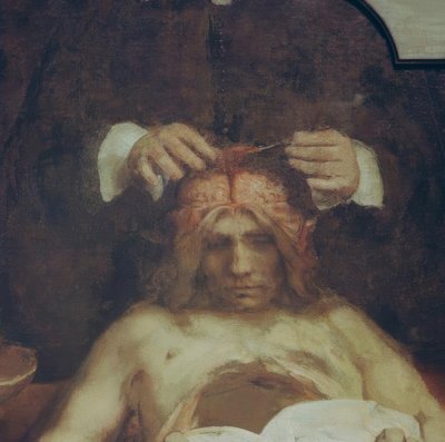 Dr. anatomisi Johan Deijman by Rembrandt van Rijn