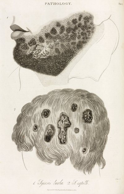 Dermatoloji Cilt hastalıkları by John Pardon