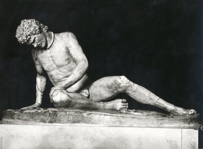Ölen Galya, MÖ 230-220 yıllarına ait bir Yunan orijinalinin Epigonos