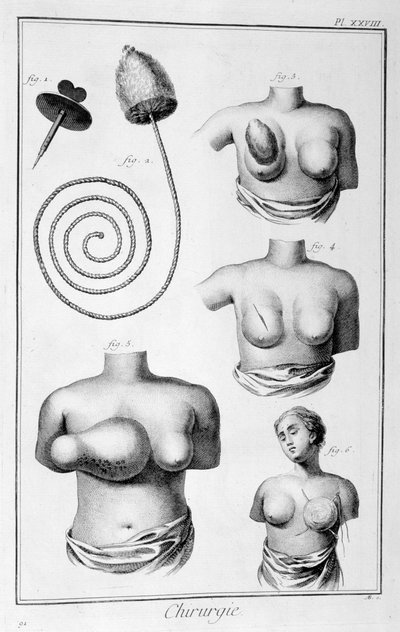 Göğüs cerrahisi, 1751-1777 by Unbekannt