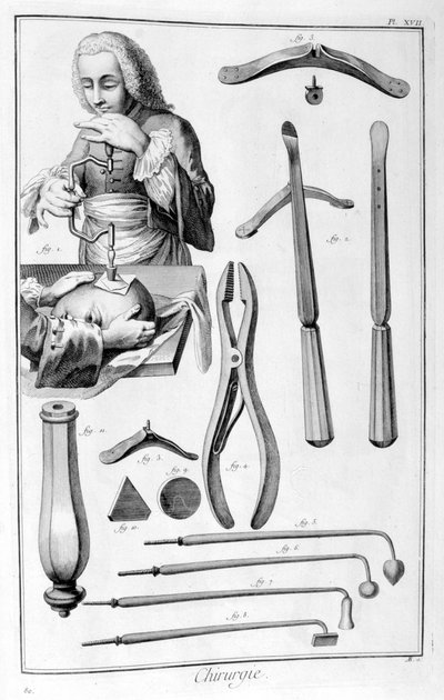 Kafa ameliyatı, 1751-1777 by Unbekannt