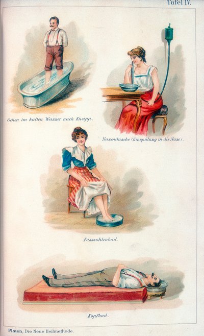 Hidroterapi tedavileri, c1902 by Unbekannt