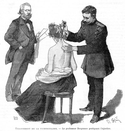 Profesör Bergmann bir tüberküloz hastasını enjekte ediyor, 1891 by Unbekannt