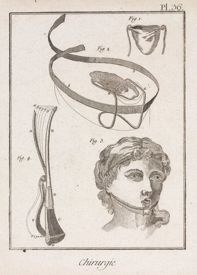 Kulak Burun Boğaz Cerrahi Cihazlar by Unbekannt