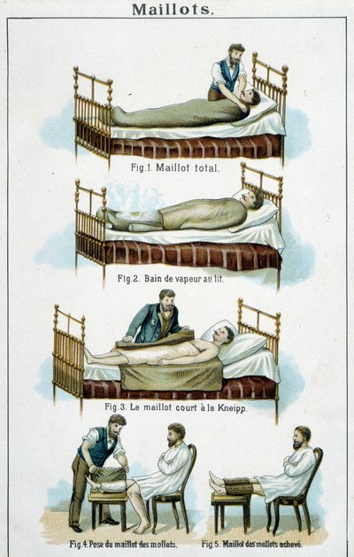 Formalar: 1) Total forma, 2) Yatakta buhar banyosu, 3) Kneipp kısa forması, 4-5) Baldır forması - “Bilz, Natural Medication”da, 19. yüzyıl sonu by Unknown artist