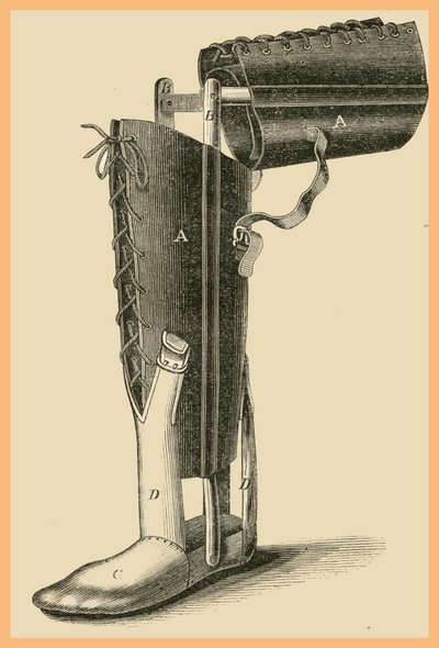 Bacak Değişimi by Unknown Artist