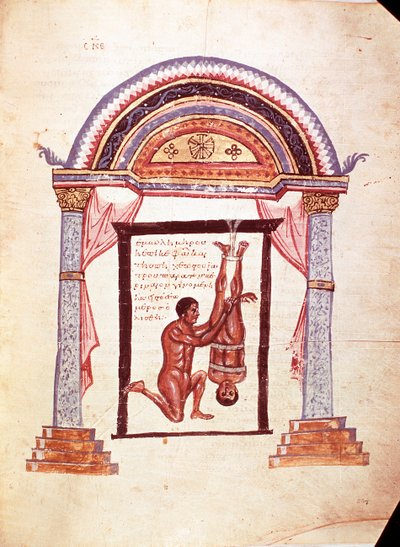 Tıp: çıkık bir dizin azaltılması, hasta ayaklarından asılır (el yazması by Unknown artist