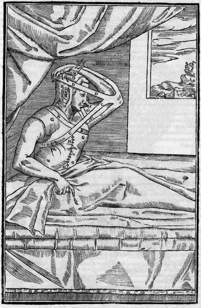 Burun cerrahisi: “De curtorum chirurgia per insitionem”de burunda rekonstrüktif cerrahi. Venedik by Unknown artist