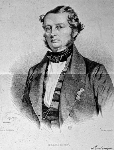 Joseph François Malgaigne