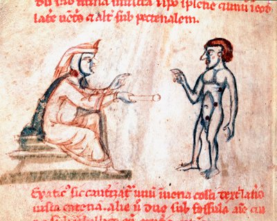 Doktor hastayı sıcak ütülerle ağrılı bölgelerde yakar “” De Medicina cauteriorum secundum Brunum, Rugerium et Rolthe” el yazmasından minyatür 13. yüzyıl Paris, B.N. by Unknown artist