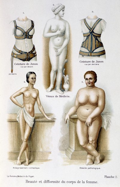 Kadın vücudunun güzelliği ve deformitesi (zayıf ve obezite); Juno