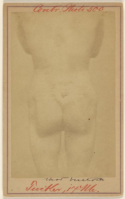 [Jno. E. Tucker, kalçasından vurulmuş, İç Savaş kurbanı] by Unknown artist