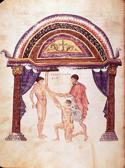 Tıp: Çıkık bir dirseğin azaltılması, hasta kolundan asılır (el yazması) by Unknown artist