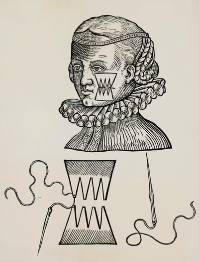 Deride dikiş izi kalmaması için yanak yarası alçı ile tedavi edilmiştir. by Unknown artist