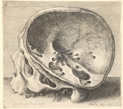 Kafatasının sol tarafı çıkarılmış, profilden sola doğru kesitli kafatası, 1651. by Wenceslaus Hollar